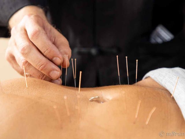 Acupuncture ventrale